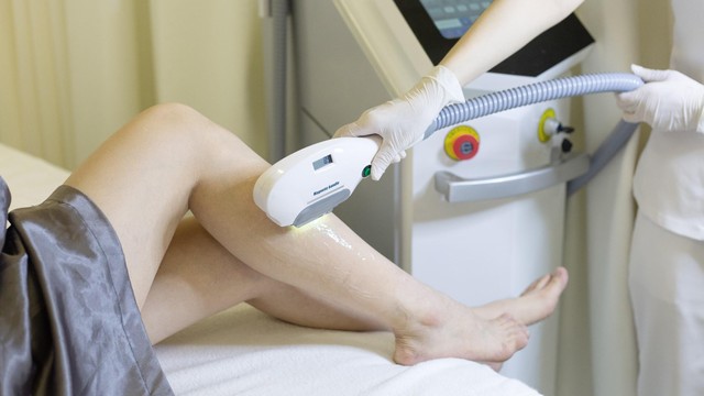 bai-viet/giua-cong-nghe-triet-long-opt-va-ipl-nen-chon-cong-nghe-nao-73105.html