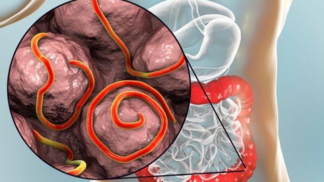 bai-viet/giun-moc-ten-khoa-hoc-la-gi-nhung-dieu-can-biet-ve-benh-giun-moc.html