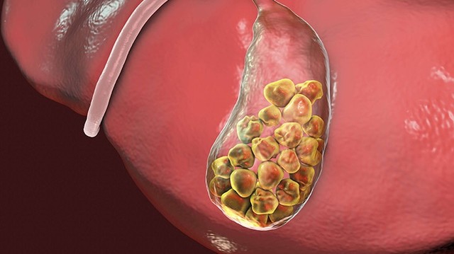 bai-viet/goc-giai-dap-soi-mat-co-di-truyen-khong-61704.html