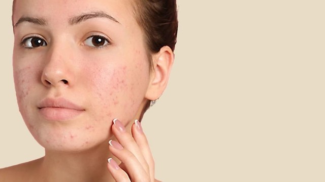 bai-viet/goc-giai-dap-thac-mac-seo-mun-co-tu-het-khong.html