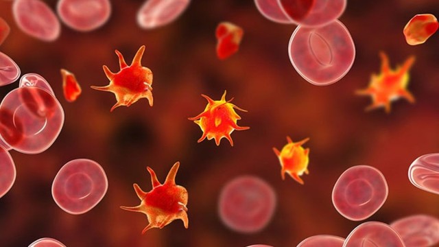 bai-viet/giam-tieu-cau-co-phai-la-ung-thu-mau-cach-phong-ngua-giam-tieu-cau.html