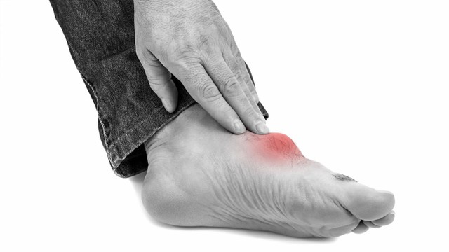 benh/gout-cap-tinh.html