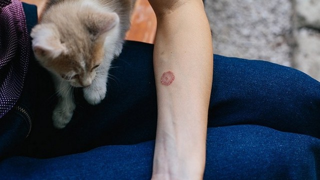 bai-viet/hac-lao-lay-tu-meo-nguyen-nhan-va-cach-xu-ly-don-gian-hieu-qua-55304.html