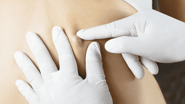 bai-viet/hat-dau-duoi-da-giai-dap-tu-chuyen-gia.html