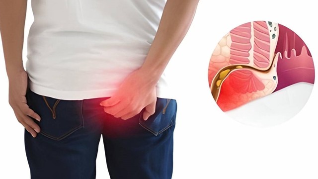 bai-viet/hau-mon-bi-sung-cho-nen-chu-quan-63860.html