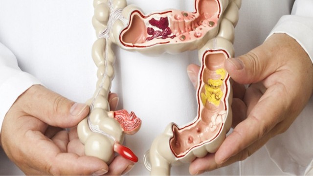 bai-viet/hau-mon-binh-thuong-co-cau-tao-va-chuc-nang-nhu-the-nao.html