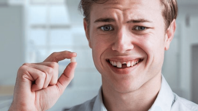 bai-viet/hau-qua-mat-rang-vinh-vien-o-nguoi-truong-thanh.html