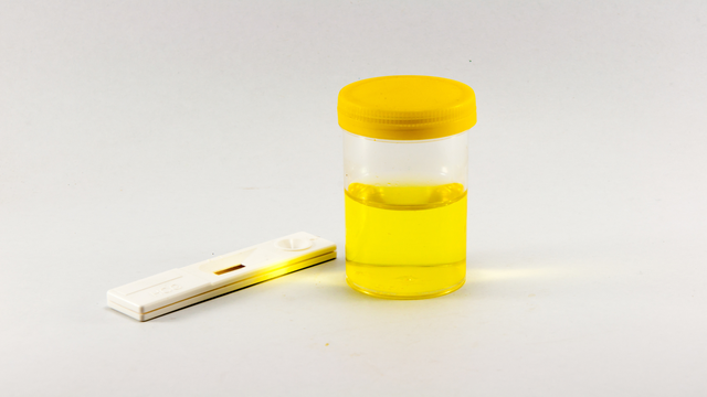 bai-viet/he-so-thanh-thai-creatinin-la-gi-cong-thuc-tinh-he-so-thanh-thai-creatinin-ra-sao.html