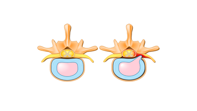 benh/hep-lo-lien-hop-dot-song-co.html