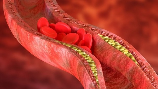 bai-viet/hep-mach-vanh-trieu-chung-phan-loai-va-muc-do-nguy-hiem.html