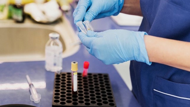 bai-viet/goc-thac-mac-xet-nghiem-ky-sinh-trung-bao-nhieu-tien.html