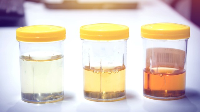 bai-viet/hien-tuong-tieu-ra-mau-o-nu-cach-nhan-biet-xu-tri-va-bien-phap-phong-ngua-hieu-qua.html