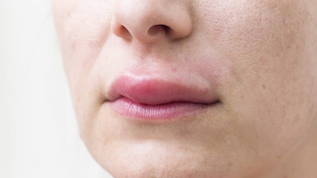 bai-viet/hieu-dung-ve-chung-me-day-phu-mach-54795.html