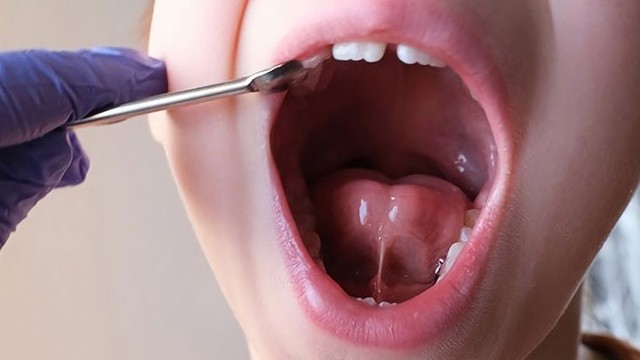 bai-viet/hinh-anh-dinh-thang-luoi-o-tre-em-la-gi-co-nguy-hiem-khong.html