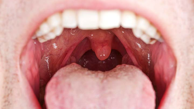 bai-viet/hinh-anh-khoang-mieng-binh-thuong-se-nhu-the-nao.html