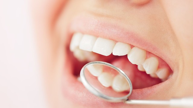 bai-viet/hinh-anh-rang-ho-nhe-cung-giai-phap-cai-thien.html