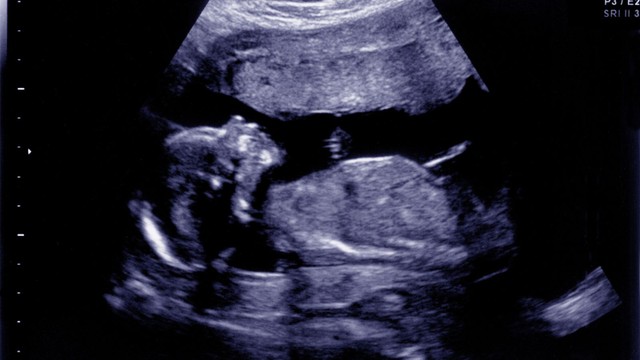 bai-viet/hinh-anh-sieu-am-be-gai-16-tuan-tuoi-nhung-dieu-me-bau-can-biet.html