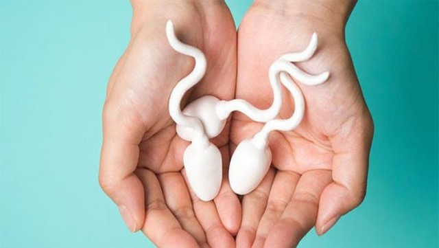 bai-viet/hinh-anh-tinh-trung-binh-thuong-la-gi-xet-nghiem-tinh-dich-do-co-y-nghia-nhu-the-nao.html