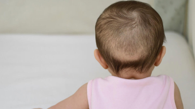 bai-viet/hinh-anh-tre-em-bi-coi-xuong-canh-bao-can-benh-nguy-hiem.html