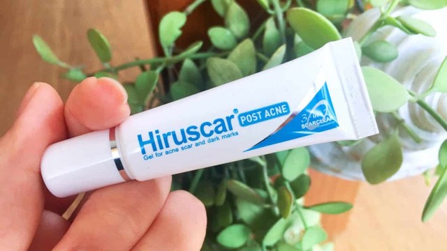 bai-viet/review-hiruscar-post-acne-chi-tiet-nhat-63117.html