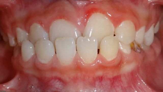 bai-viet/ho-ham-duoi-nguyen-nhan-tac-hai-va-phuong-huong-khac-phuc.html