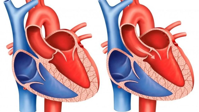 bai-viet/ho-van-dong-mach-chu-1-4-co-nguy-hiem-khong.html