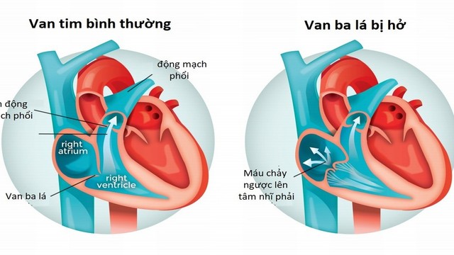 bai-viet/nhung-cay-thuoc-nam-chua-benh-ho-van-tim-cuc-ky-hieu-qua-va-an-toan.html