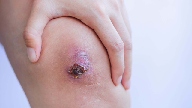 bai-viet/hoai-tu-da-va-nhung-dieu-ban-can-biet.html