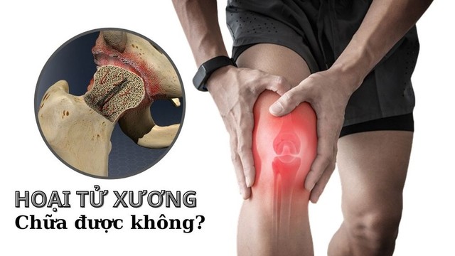 bai-viet/hoai-tu-xuong-co-chua-duoc-khong.html