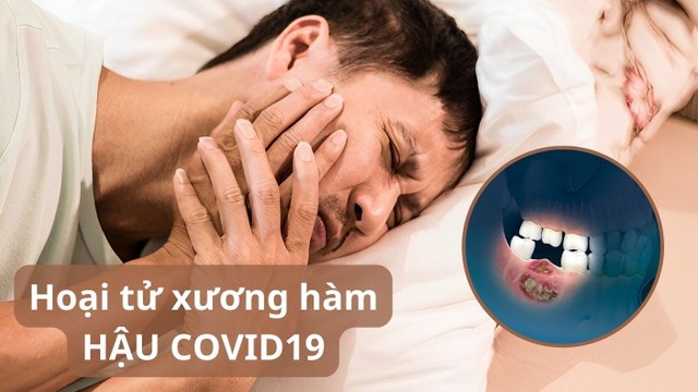 bai-viet/tim-hieu-chi-tiet-ve-tinh-trang-hoai-tu-xuong-ham-hau-covid.html