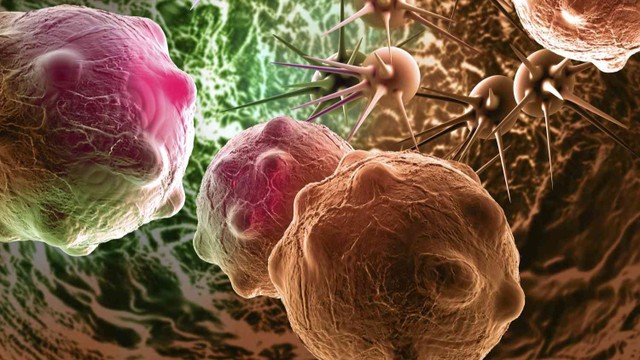 Hội chứng cận u