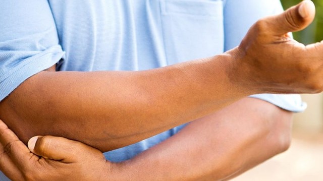 bai-viet/hoi-chung-kenh-guyon-co-che-gay-benh-dau-hieu-nhan-biet-va-xu-tri.html