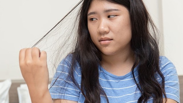 bai-viet/nhung-dieu-ban-nen-biet-ve-hoi-chung-nghien-giat-toc.html