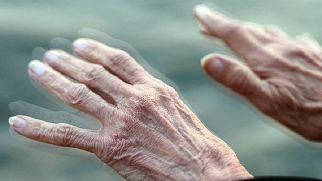 bai-viet/hoi-chung-parkinson-nguyen-nhan-trieu-chung-cach-chan-doan-va-phuong-phap-dieu-tri-70719.html