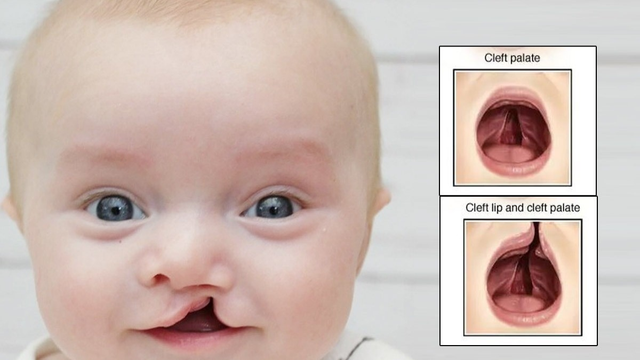 bai-viet/hoi-chung-trisomy-13-la-gi-nguyen-nhan-trieu-chung-va-phuong-phap-sang-loc.html