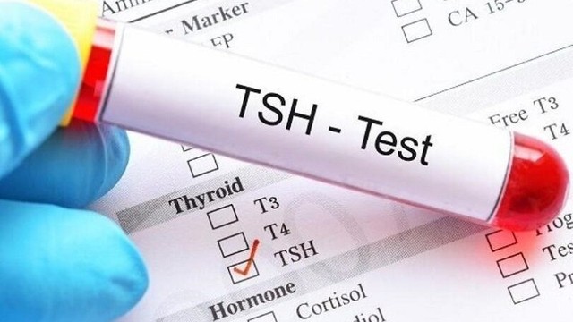 bai-viet/hormone-tsh-la-gi-xet-nghiem-tsh-la-gi.html