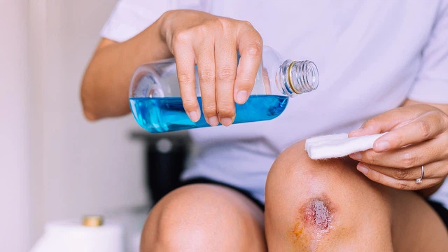 bai-viet/tai-sao-cac-vet-thuong-lai-co-vay-lo-boc-vay-vet-thuong-thi-phai-lam-sao.html