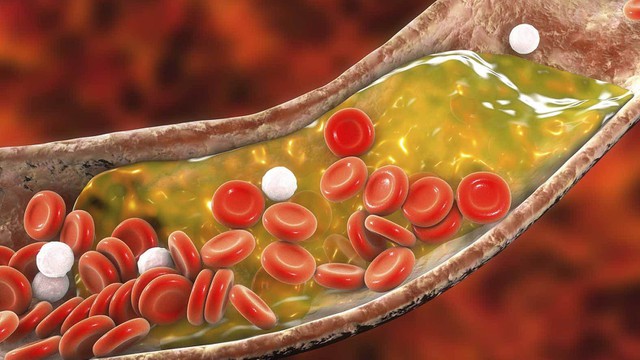 bai-viet/5-cach-giup-ban-giam-cholesterol-va-phong-ngua-dot-quy.html