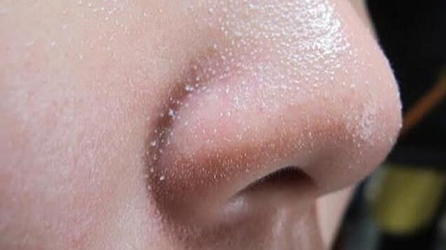 bai-viet/6-cach-loai-bo-soi-ba-nhon-de-dang-ban-da-biet-chua-67539.html