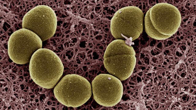 bai-viet/enterococcus-faecalis-vi-khuan-vua-co-loi-vua-co-hai-trong-co-the-nguoi.html