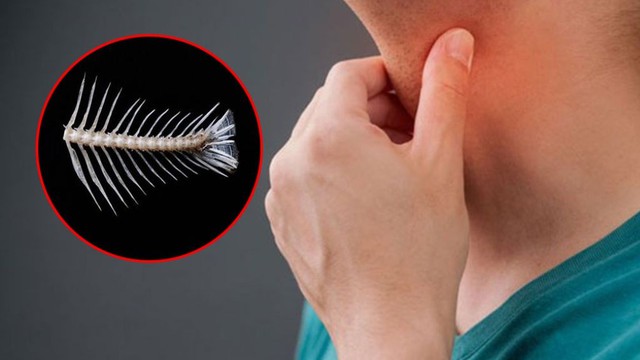 bai-viet/hoc-xuong-ca-uong-thuoc-gi-nhanh-khoi-nhung-cach-chua-hoc-xuong-ca-ngay-tai-nha.html