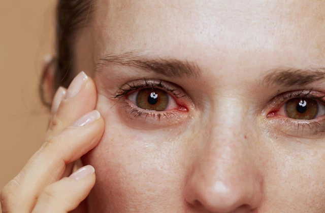 benh/hoi-chung-sjogren-1268.html