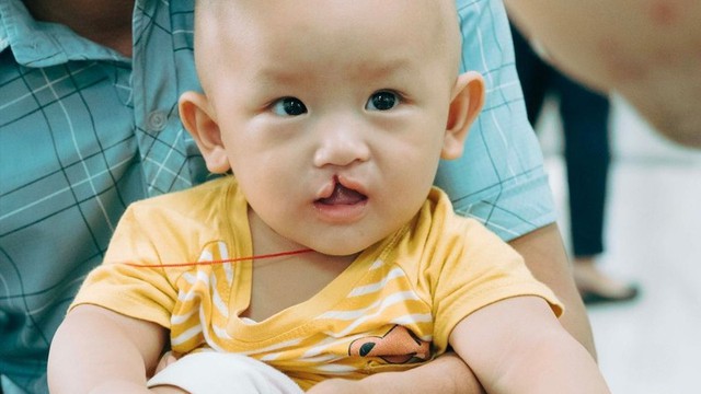 bai-viet/tre-bi-sut-moi-4mm-phai-khac-phuc-nhu-the-nao.html