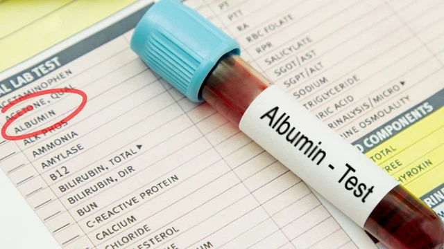 bai-viet/albumin-la-gi-y-nghia-cua-xet-nghiem-albumin-voi-suc-khoe-con-nguoi-62707.html