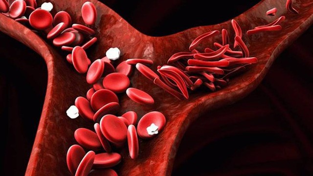 bai-viet/anemia-nguyen-nhan-dau-hieu-va-phuong-phap-dieu-tri.html