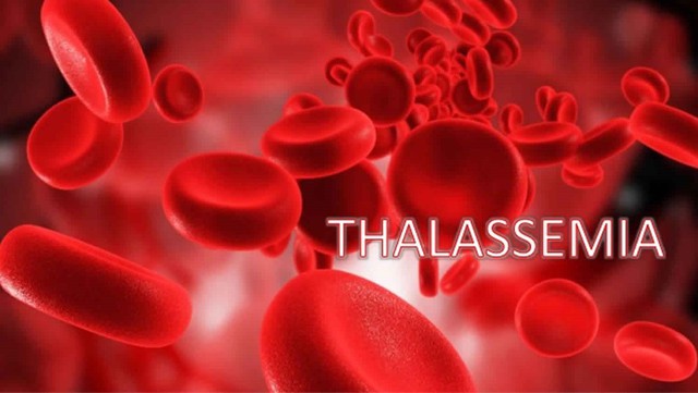 bai-viet/benh-thalassemia-the-an-la-benh-gi-phuong-phap-dieu-tri-thalassemia-the-an.html
