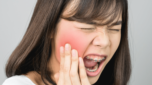 bai-viet/bi-dau-quai-ham-gan-tai-ben-trai-la-trieu-chung-cua-benh-gi-72698.html