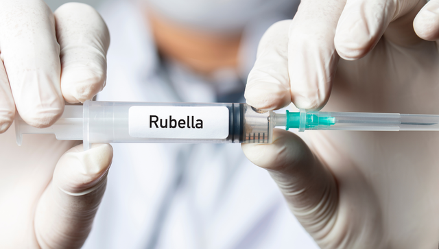 bai-viet/bi-rubella-roi-co-bi-lai-khong-nhung-phuong-phap-phong-ngua-rubella-hieu-qua.html