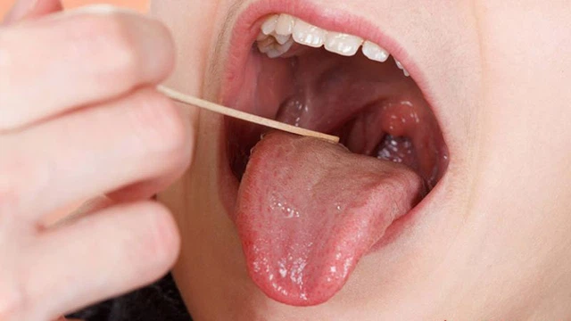 bai-viet/bi-vuong-dom-o-co-hong-lam-gi-de-khac-phuc.html