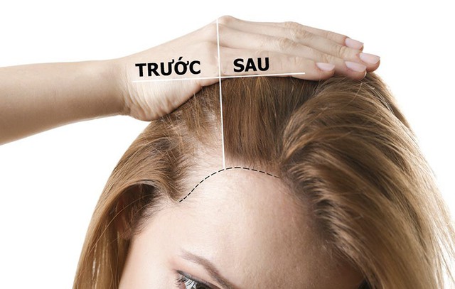 bai-viet/bo-tui-6-meo-giup-kich-thich-moc-toc-hieu-qua-tai-nha-49569.html